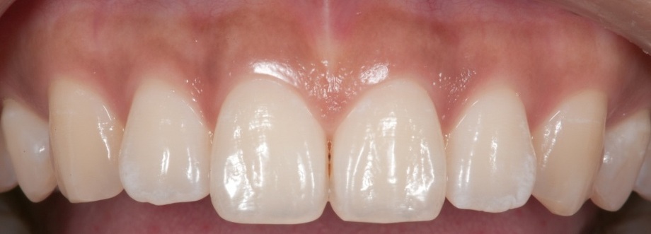 歯周病治療のコンセプトのイメージ